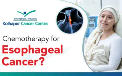 Is chemotherapy painful for esophageal cancer?
