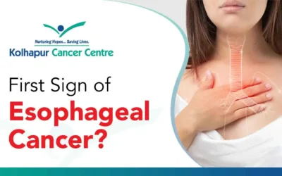 What is the First Sign of Esophageal Cancer?