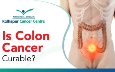 Is Colon Cancer Treatable?
