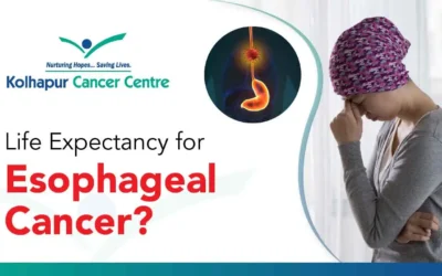 What is the Life Expectancy For Esophageal Cancer?
