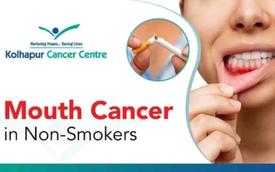 What Causes Mouth Cancer in a Non-Smoker?