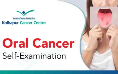 How to self-examine symptoms of oral cancer?