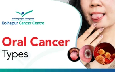 What Are The Different Types of Oral Cancer?
