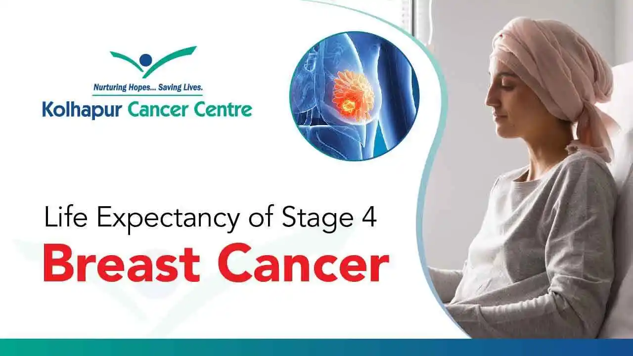 Life Expectancy of Stage 4 Breast Cancer