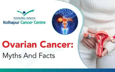 Ovarian Cancer: Myths vs. Facts