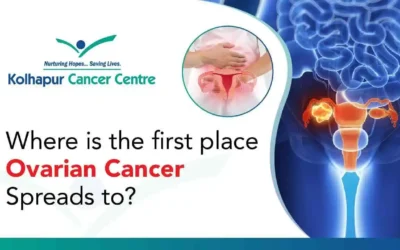 Where is the first place ovarian cancer spreads to?
