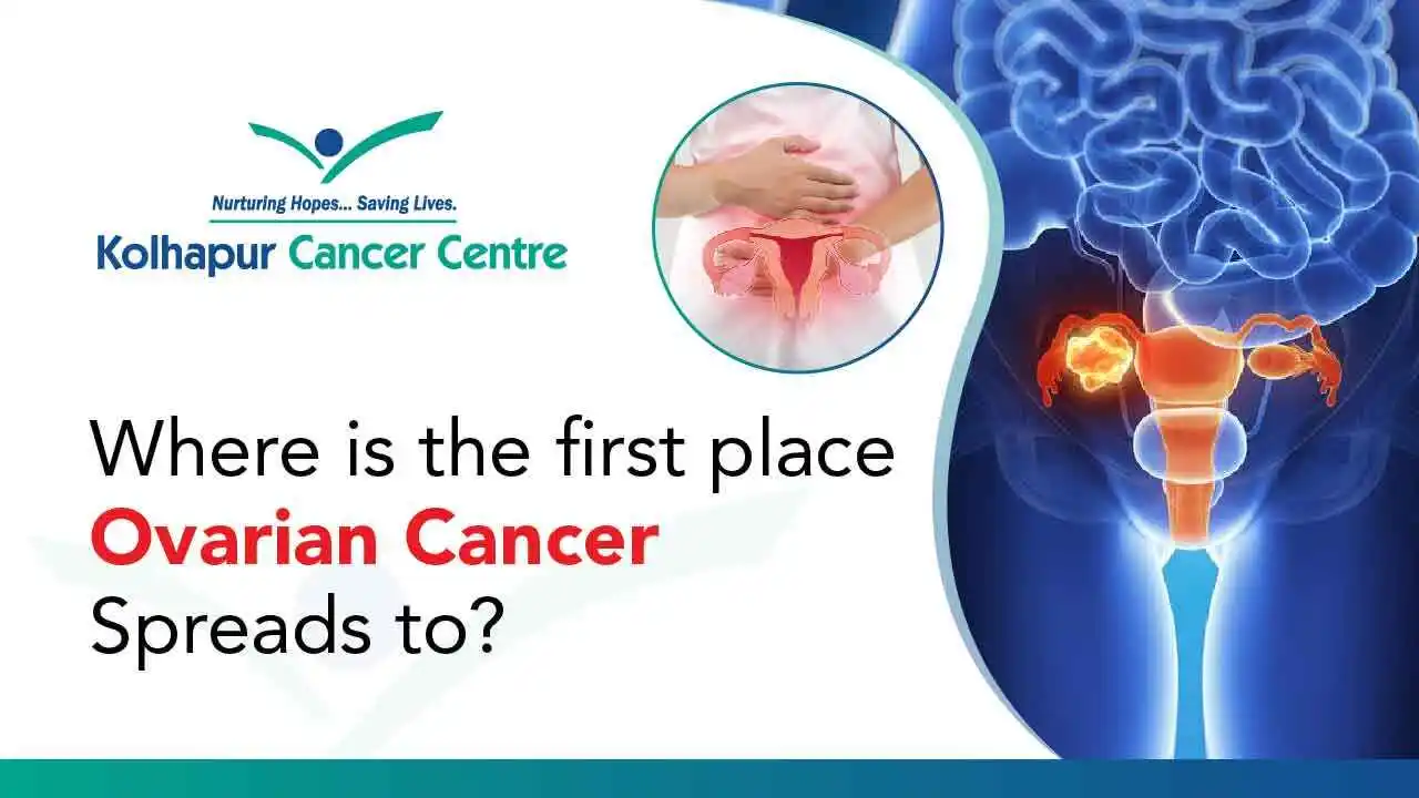 Where is the first place ovarian cancer spreads to?