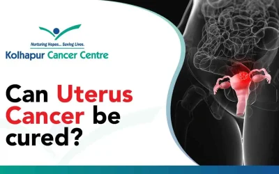 Is Uterus Cancer curable?