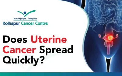 Does Uterine Cancer Spread Quickly?