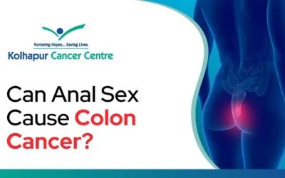 Can Anal Sex Cause Colon Cancer?