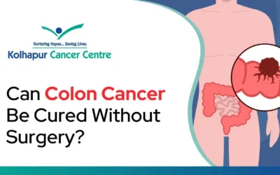 Can colon cancer be cured without surgery?