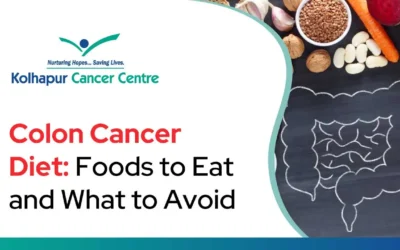 Colon Cancer Diet: Foods to Eat and What to Avoid