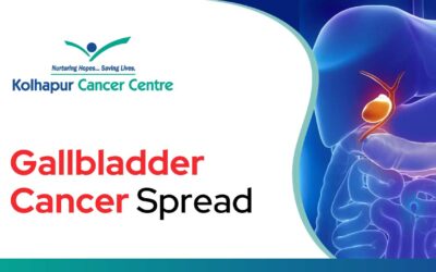 How Quickly Does Gallbladder Cancer Spread