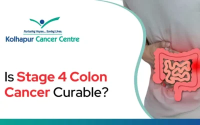 Is stage 4 colon cancer curable?