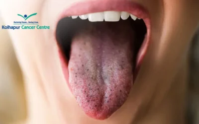 Oral Cancer Black Spot On Tongue