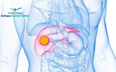 Can you survive metastatic liver cancer?