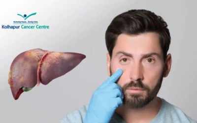 Can Liver Cancer Cause Jaundice?