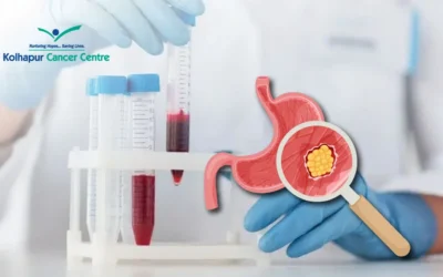 Can a Blood Test Detect Stomach Cancer?