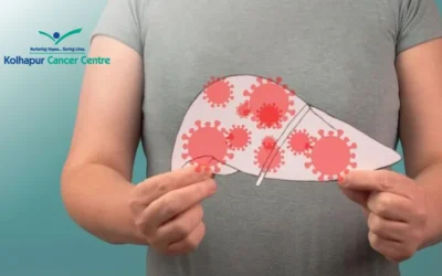 Understanding Liver Cancer Prognosis by Stage