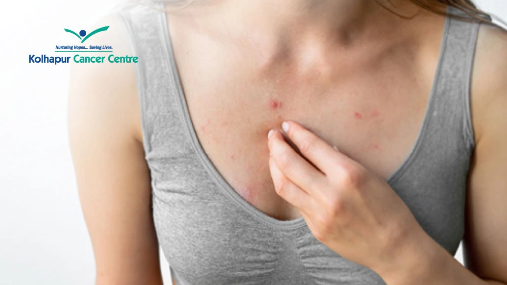 What-Causes-Pimple-on-Breast-Is-It-Breast-Cancer What-Causes-Pimple-on-Breast-Is-It-Breast-Cancer